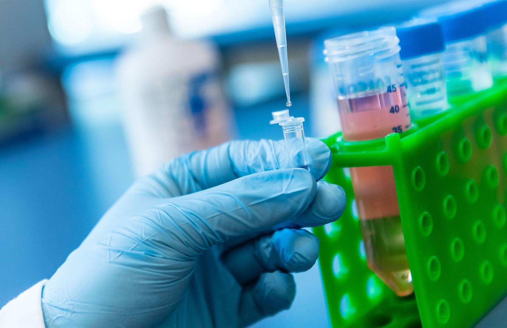 A gloved hand holds laboratory equipment during a disease research trial.